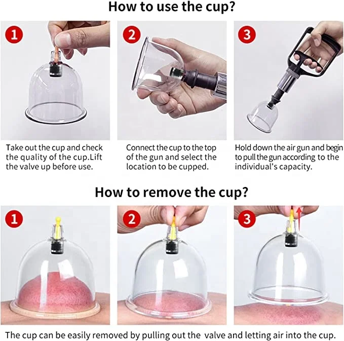 32 Therapy Cups Cupping Set with Pump Professional Chinese Acupoint Cupping Therapy Sets Hijama for Cupping Massage