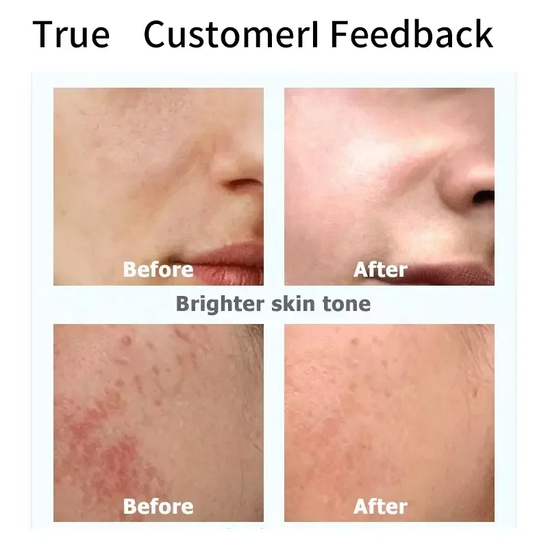 moisturizer with glutathione Murad Vita-C Triple Exfoliating Facial main image 0
