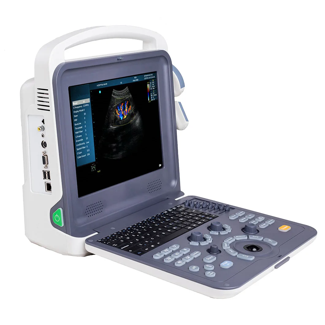 HUC-260 Hand-carried Fibroscan Machine Portable Color Dopler Diagnostic Ultrasound Scanner factory
