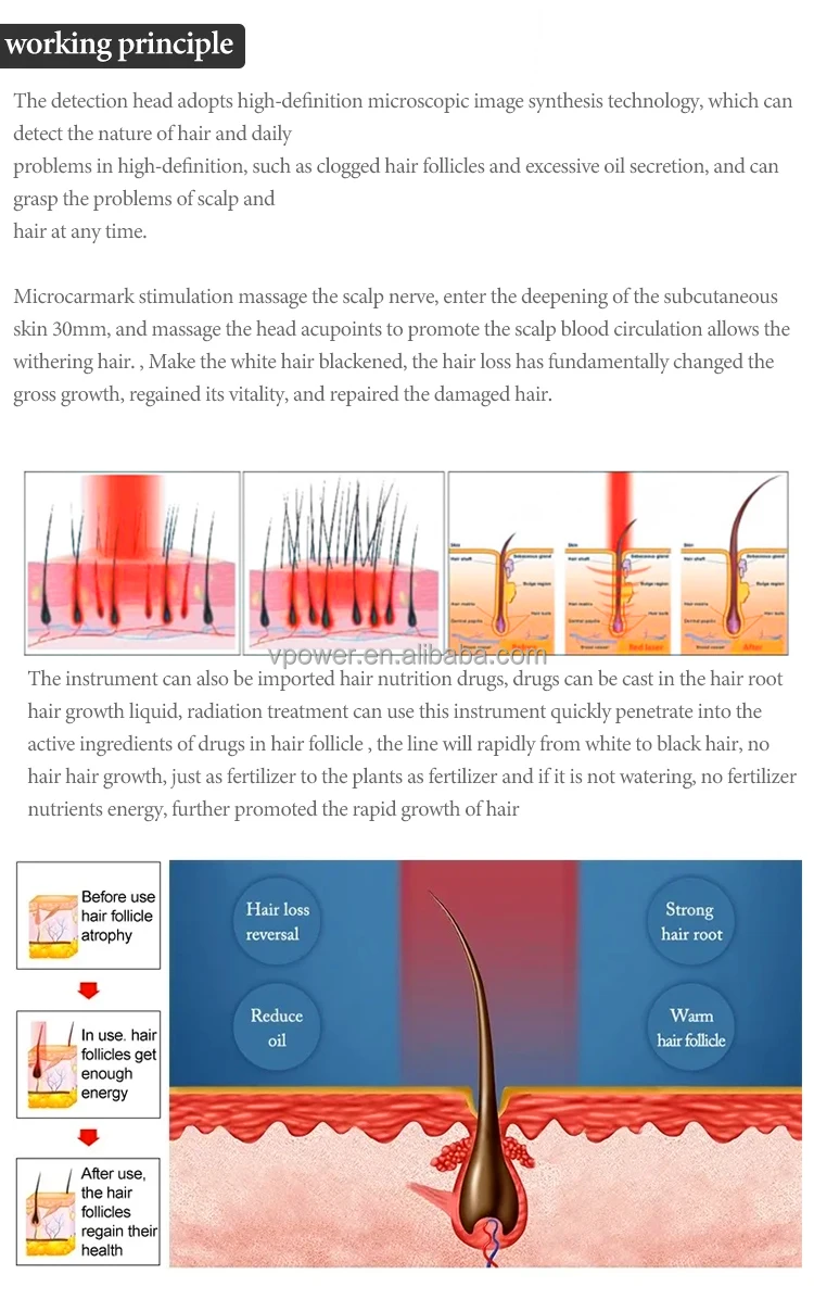 Dermasha 2024 Hair Growth Machine For Professionals Scalp Analyzer Skin