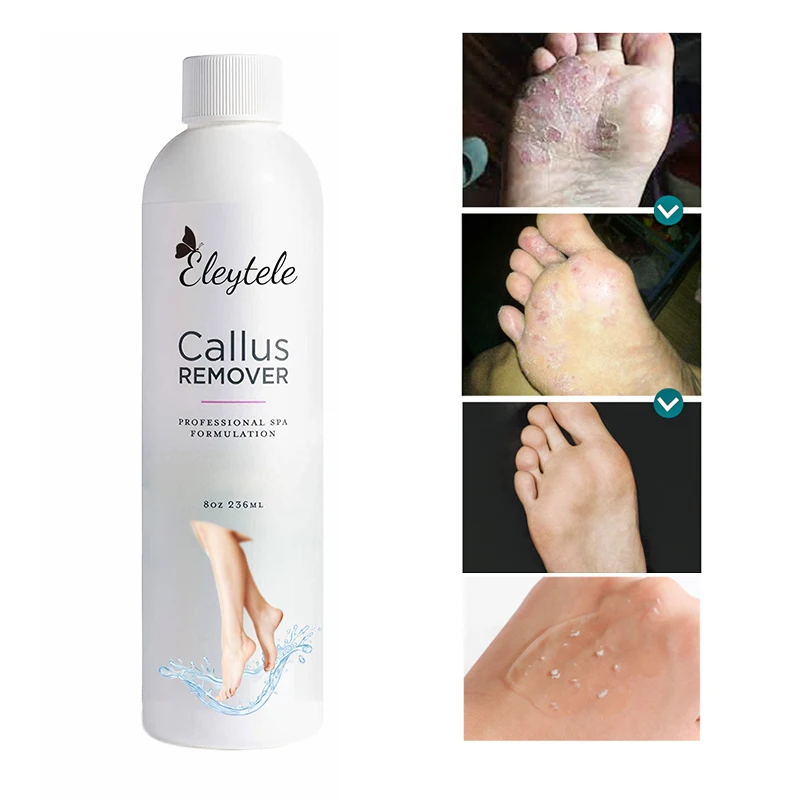 Professional Foot Care Tea Tree Oil Peeling Exfoliating File Callus