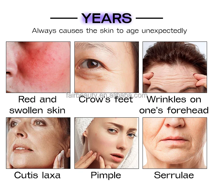 HIFU and RF Microneedling Handpieces