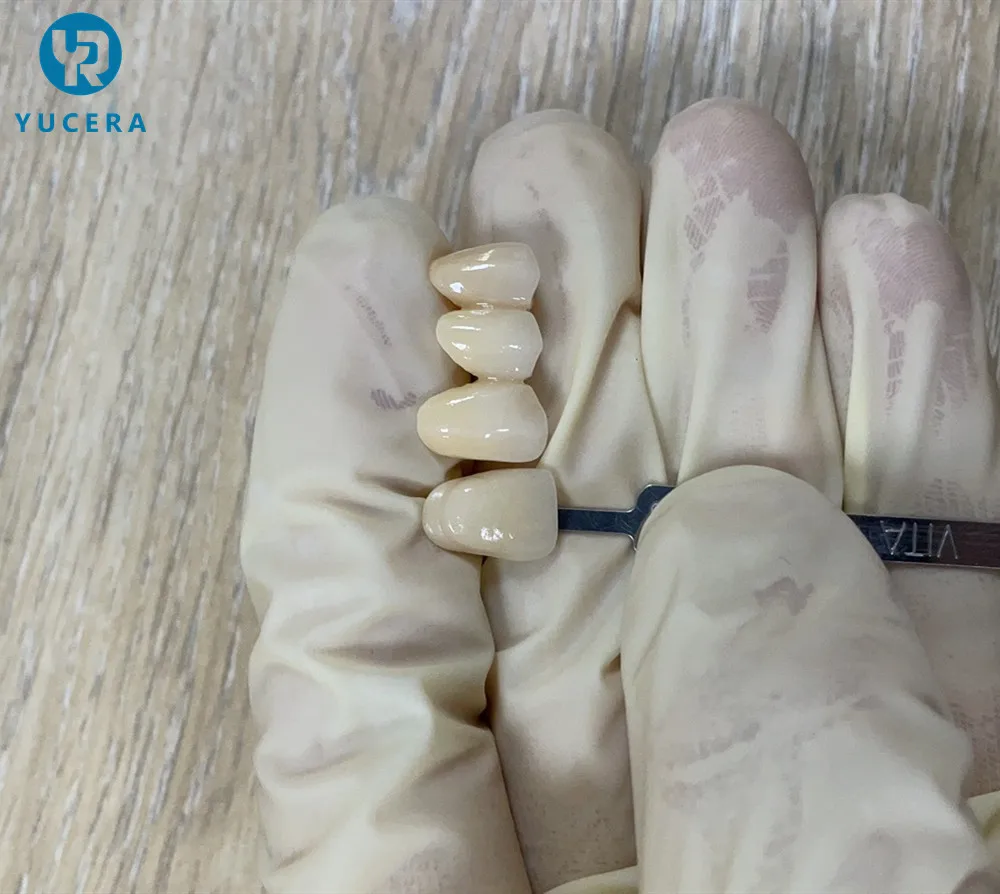 YUCERA 1200MPa 98 HT Dental Zirconia Blocks Dental Consumable Pre Shaded Zirconia Dental Zirconia Block