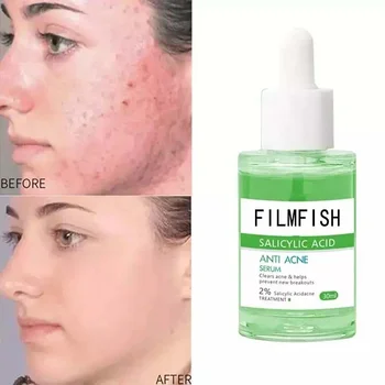 30ml Filmfish Lightens Acne Marks Fights Acne Shrinks Pores Removes Acne Essence