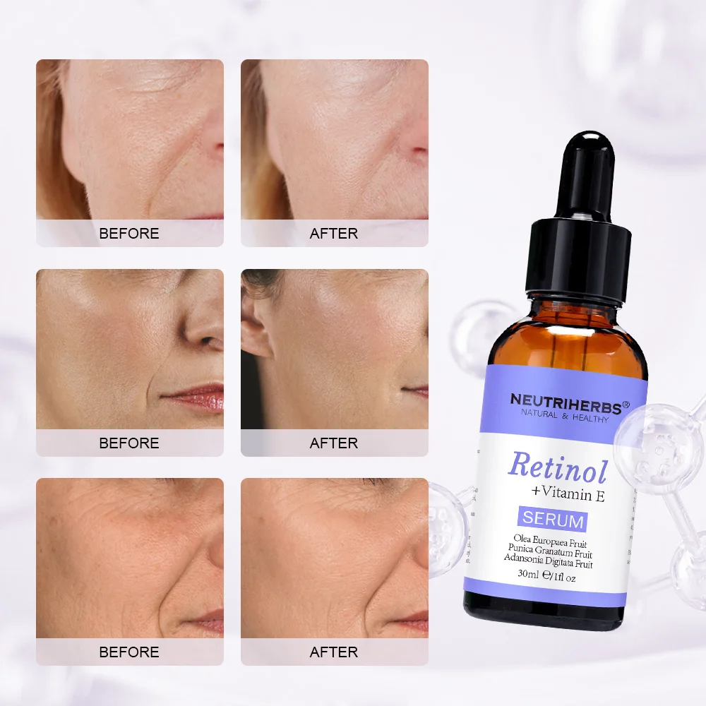 Beauty Care Products Wholesale Neutriherbs Pure Retinol Concentrated  Vitamin E Oil Skin Repairing Serum for Skin Care