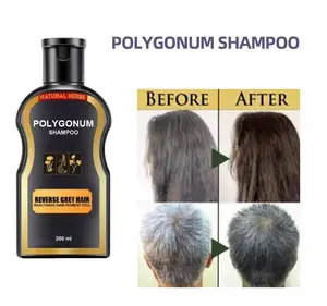 Costom Factory Wholesale Best Natural Organic Moisturizing Herbal Polygonum Multiflorum Hair Growth Darkening Shampoo