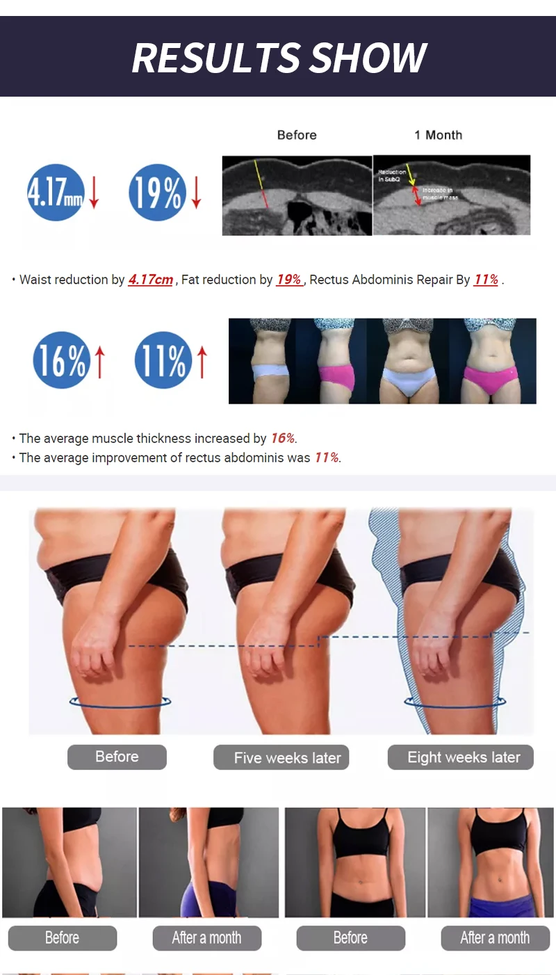 Professional EMSzero 2025 ems neo sculpting Slimming Machine 15 Tesla Hi-emt RF Nova Body Sculpture Muscle Stimulator RF 6500W
