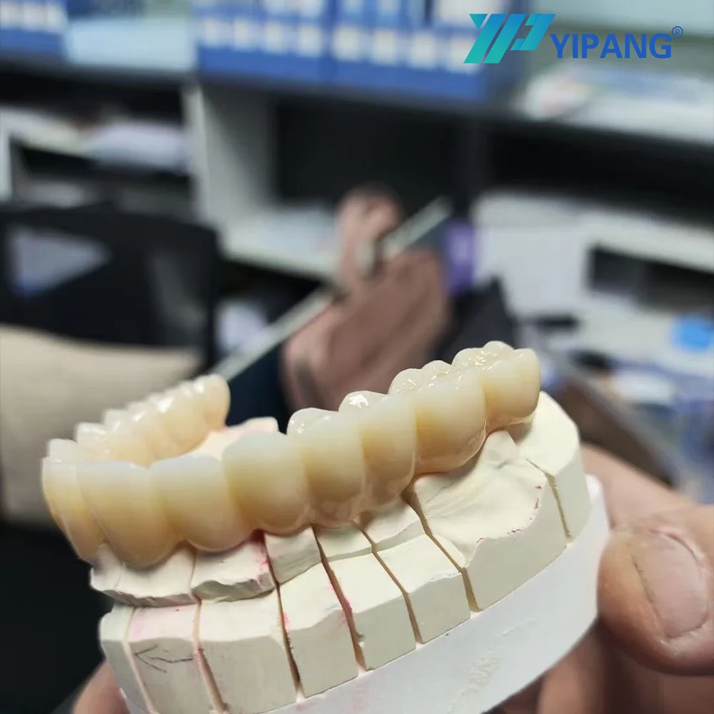 5D New Style Super Translucent Layered Block Zirconium Block Dental Lab Porcelain Moldable Dentures False Teeth