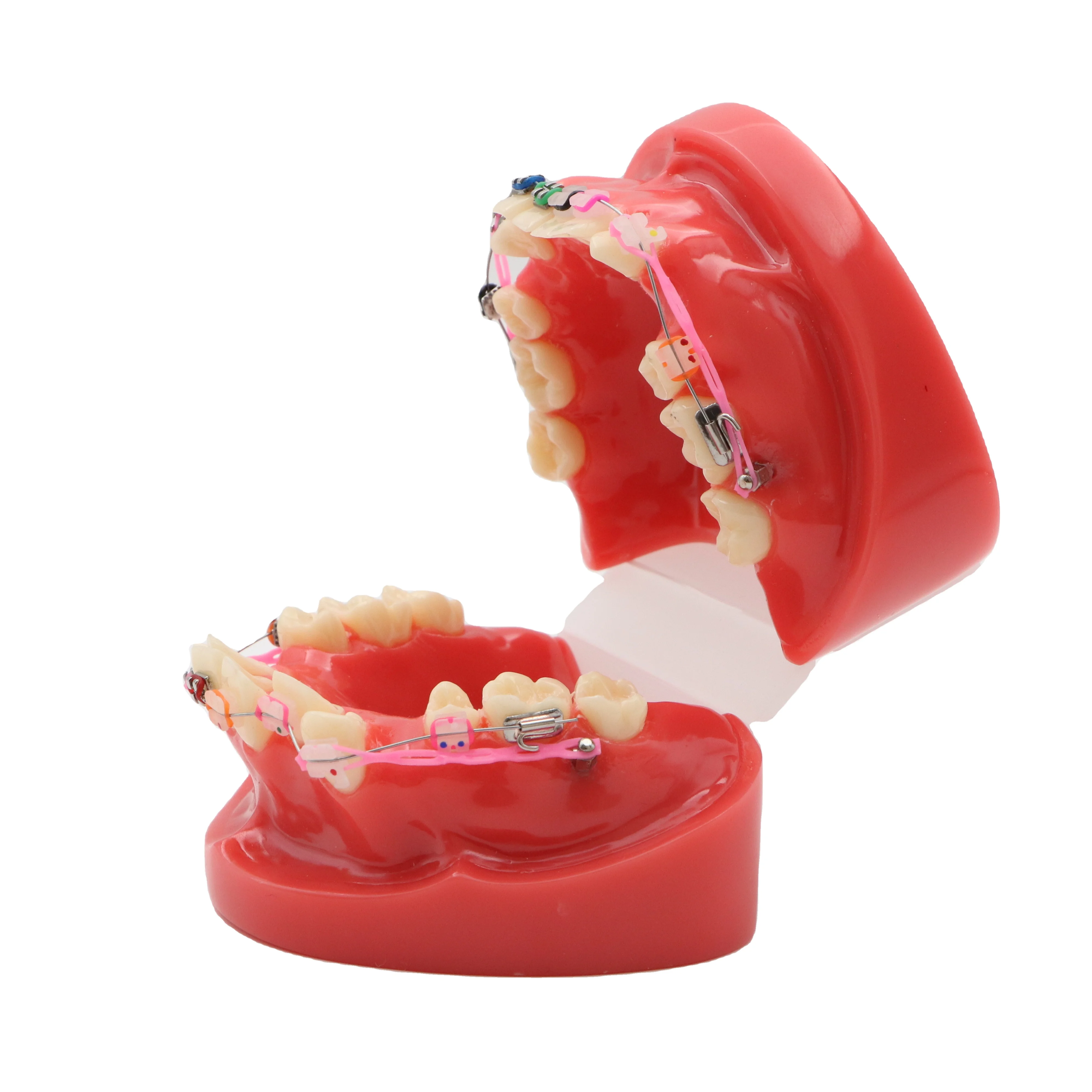 thumbnail image 2 of Orthodontic Dental Teeth Model – Typodont Demonstration With Metal Bracket Tubes 2 of 2