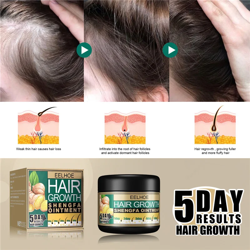 Eelhoe 30g 100g Ginger 5 Day Hair Growth Shengfa Ointment Dandruff 