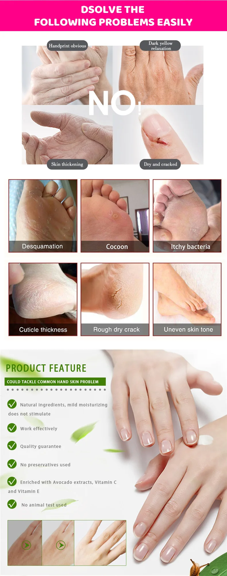 RTS лучшие продажи глубокий ремонт пальцы рук и ног крем на основе улиточного секрета (муцин) для упаковки крема увлажняющий от трещин