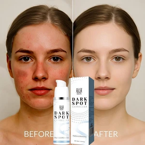 Calantha Wholesale Anti-Wrinkle Whitening Acne Spot-Reduction Brightening Facial Serum Niacinamide Lemon Turmeric Vitamin C Pore