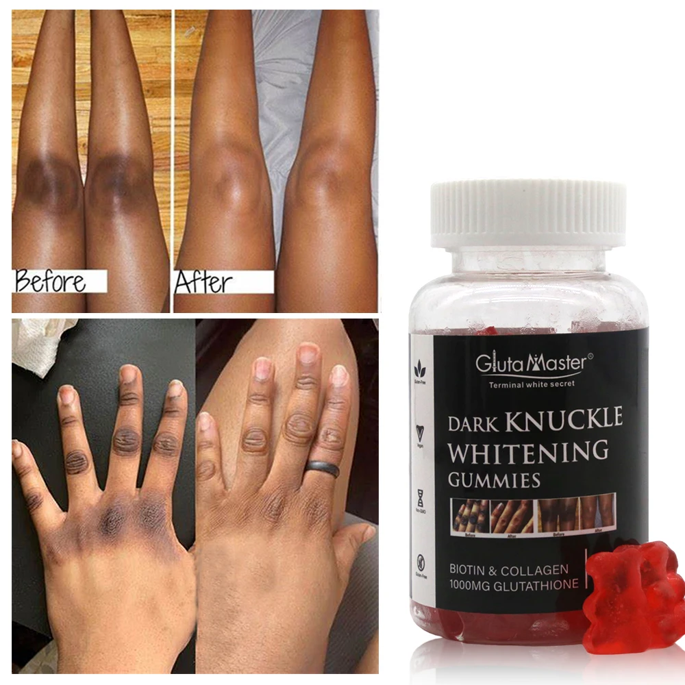 Remove Dark Knuckle Super Whitening Gummies Biotin Collagen Gummies Glowing  Candy Private Label Gummy Health Supplement