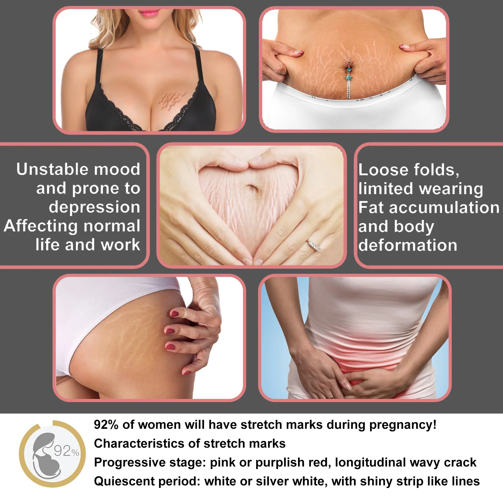 Hot Sale Vegan Stretch Marks Removal Cream Postpartum Body Care Repair Firming Stretch Marks Cream