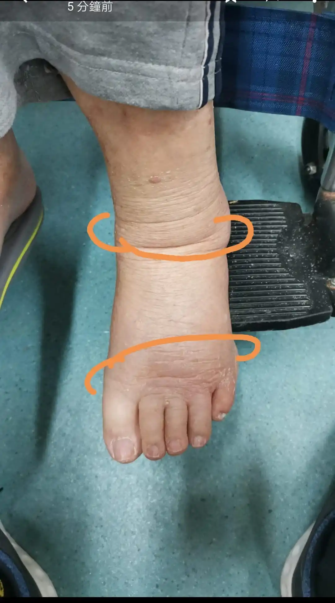 Oem Good Quality Breathable Woven Adjustable Health Care Product