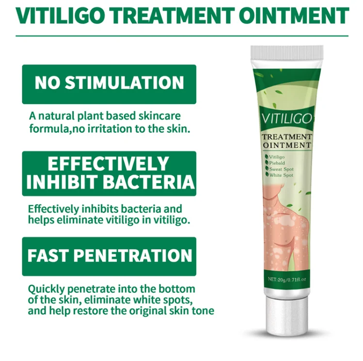 White Spot Removing Body Herbal Skin Care Relief Cream White Spot Removing Body Herbal Skin Care Relief Cream