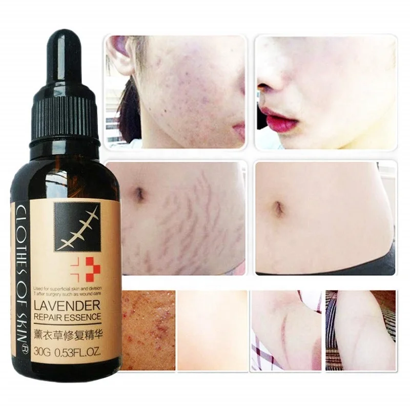 
 Натуральное средство для удаления шрамов, лаванда, 30 мл  