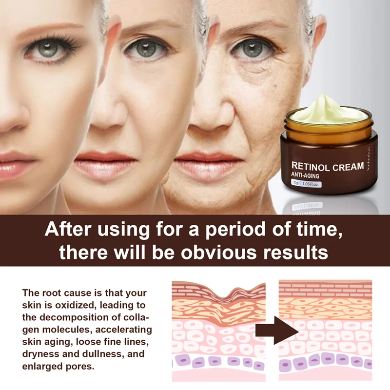private label organic remove wrinkle hyaluronic acid moisturizer anti aging retinol face cream