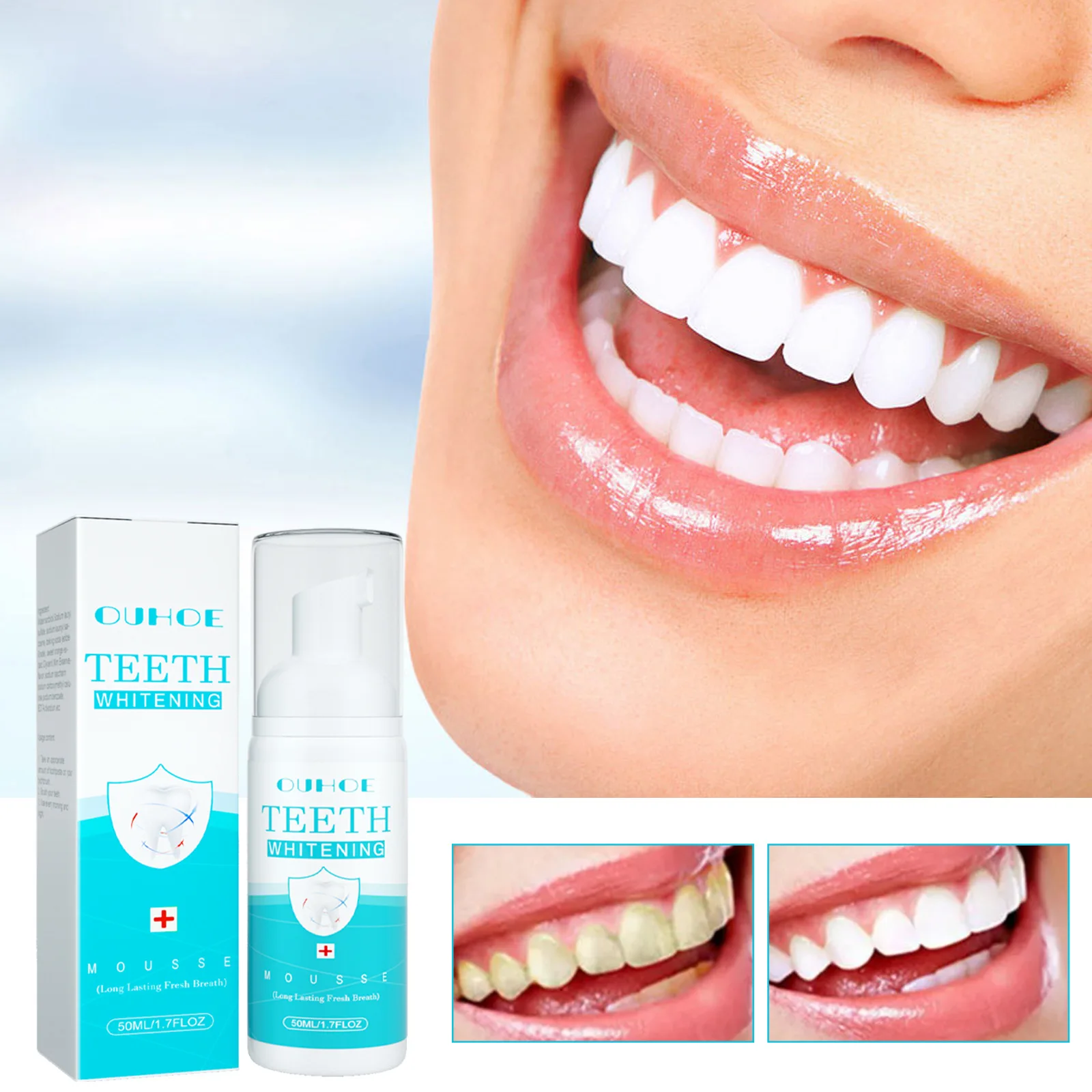 Ouhoe White Teeth Mousse Clean Tartar Oral Care Anti-decay Fresh Breath 