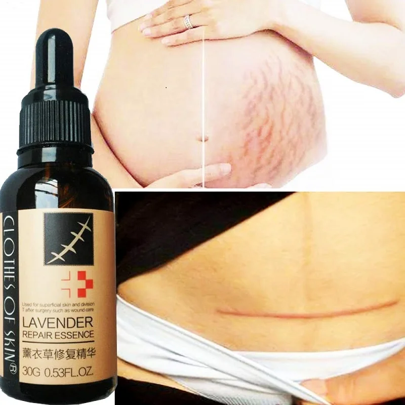 
 Натуральное средство для удаления шрамов, лаванда, 30 мл  