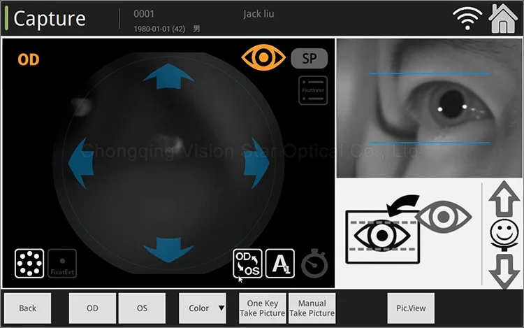 Professional Medical Equipment Non-Mydriatic Eye Fundus Camera for Retinal Examination