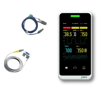 Cheap Price for 24-Hour Graphic Trend Storage Intubated Non-Intubated Clinical SpO2 and CO2 Monitor for Vets Pets
