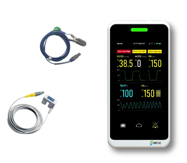 Cheap Price for 24-Hour Graphic Trend Storage Intubated Non-Intubated Clinical SpO2 and CO2 Monitor for Vets Pets