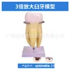 3x magnification of molar anatomy