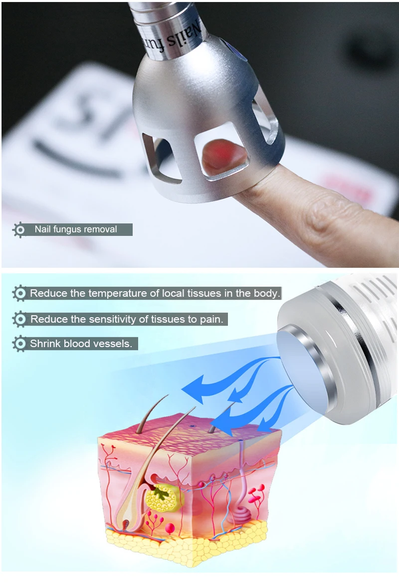 Лазер для удаления кровеносных сосудов, 40 Вт, 3 в 1, нм, диодный лазер, сосудистый очиститель, удаление венозных сосудов для использования в салоне красоты