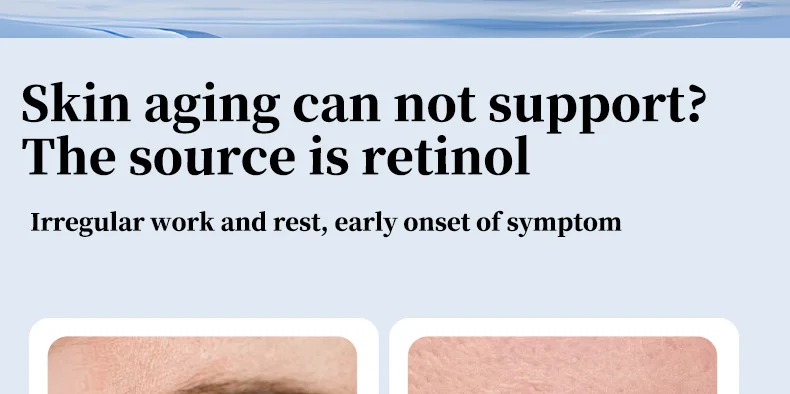 Retinol Moisturizer for Anti-Aging - Moisturizes & Improves Skin Elasticity Suitable for All Skin(pic5)