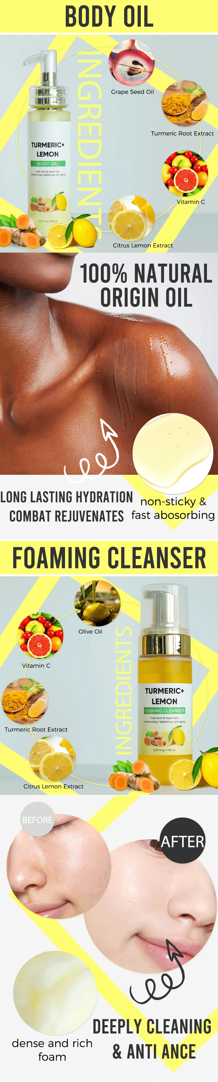 Acne Treatment Aloe Vera Turmeric Oil Face Cream Serum Turmeric