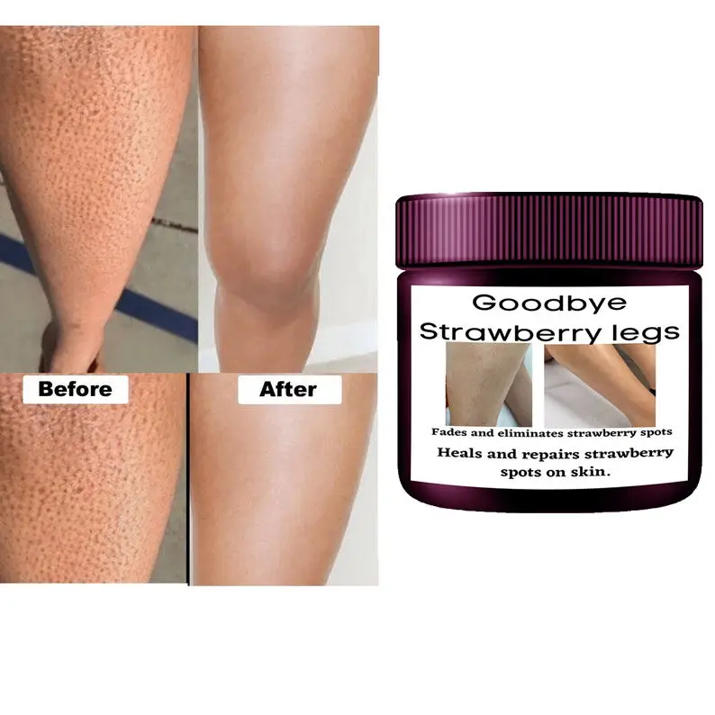 7 Days Whitening Strawberry Legs Cream Fades Strawberry Spots Skin