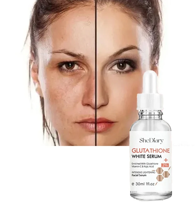 SheDiary-suero blanqueador de glutatión para pecas, elimina las manchas oscuras del melasma, suero blanqueador facial con vitamina C, ácido kójico