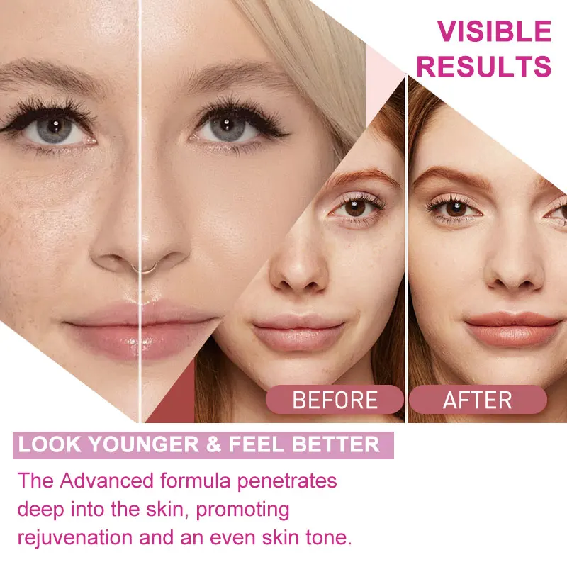 l glutathione results Glutathione Results: 5 Things I Wish I Knew Before Starting – P É T A L E Z main image 0