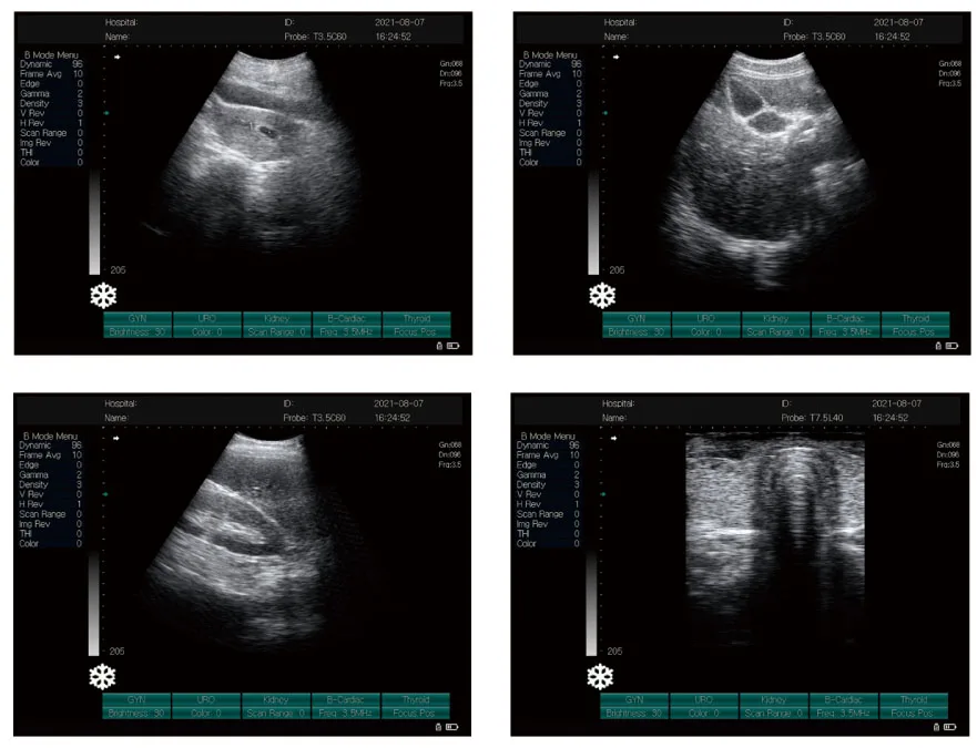 High Quality Hospital Use Portable All Digital Laptop Ultrasound Machine With Dual Probe Interface supplier