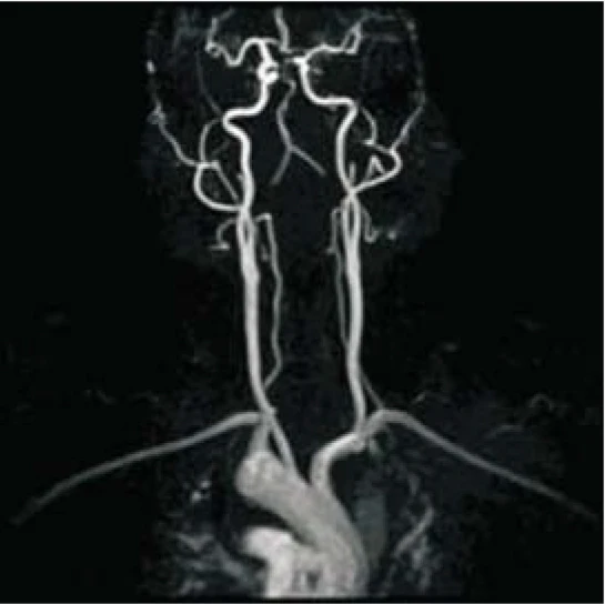 Hospital Medical Magnetic Resonance Imaging System 1.5T  MRI Machine with A-combi and Al Technologies factory