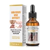 Knuckle Whitening Serum