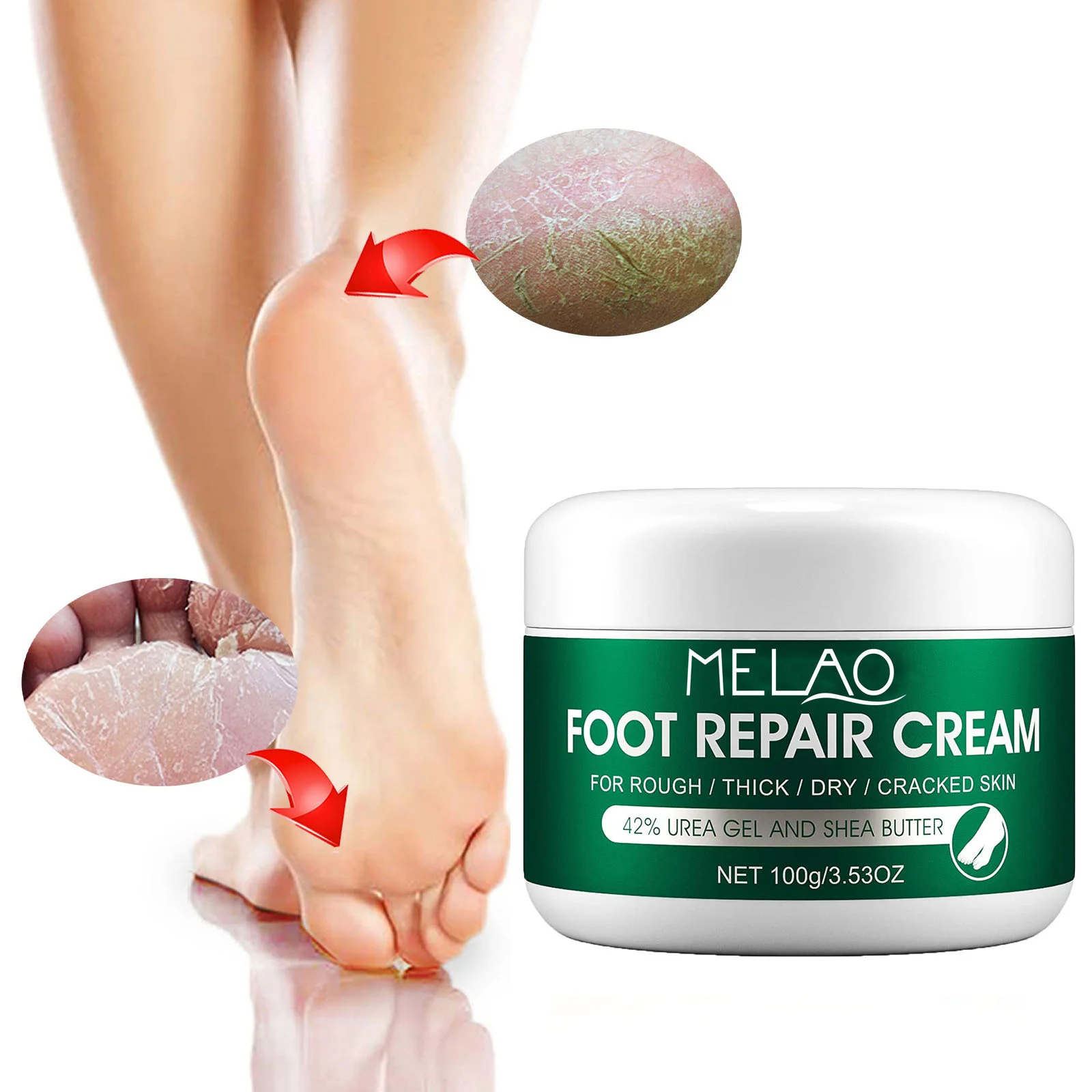 Melao Best Sellers Urea Cream Foot Care Foot Repair Cream For Rough ...