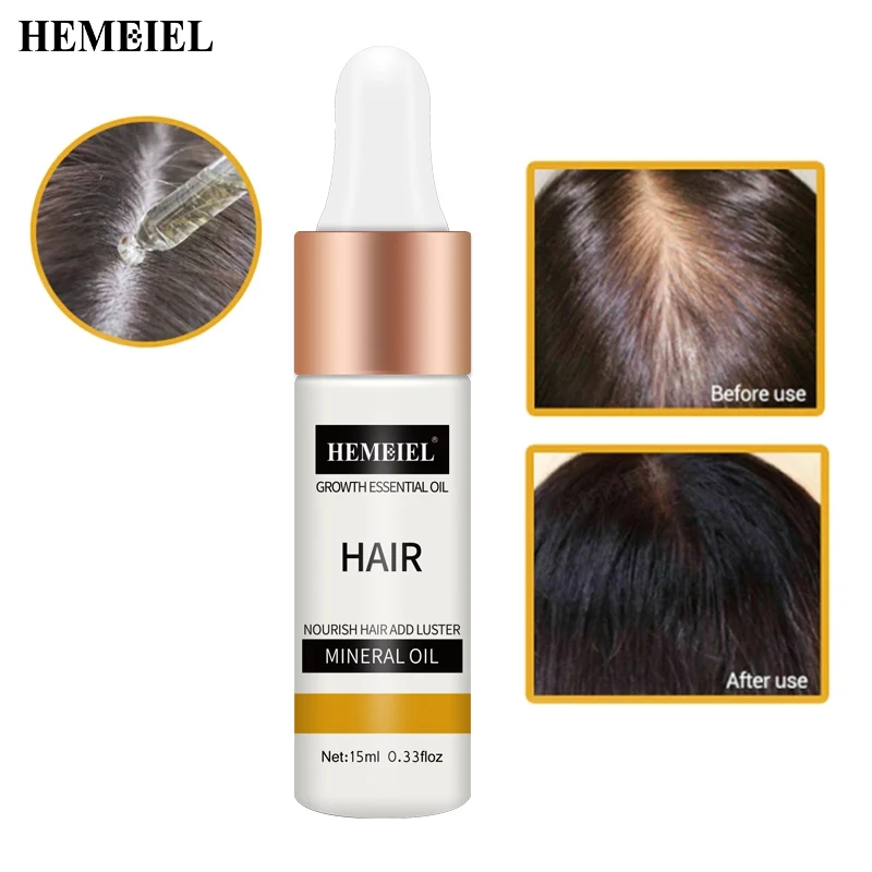 Женское и мужское средство против выпадения волос Органическая травяная Сыворотка для роста натуральная Фирменная торговая марка травяное лучшее