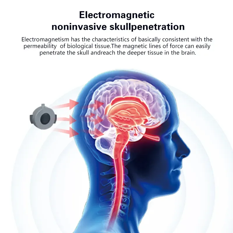 Brain Therapy Device Transcranial Magnetic Stimulation Therapeutic ...