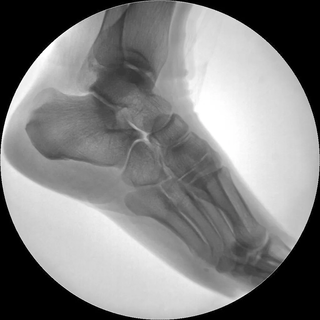 China Cheap Price High Frequency Portable Mobile c Arm System X Ray Machine