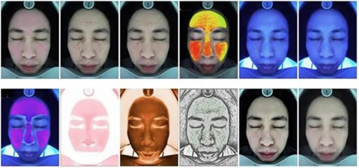 Facial Moisture Analyzer