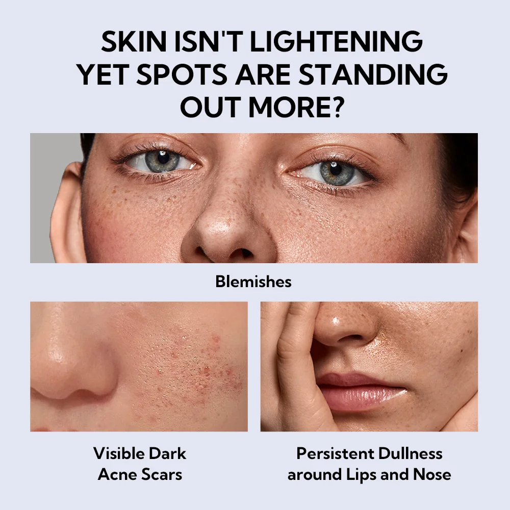 Lanbena Wholesale Niacinamide Serum for Face, Anti Aging Serum, Hydrating Serum for Moisturize Skin factory
