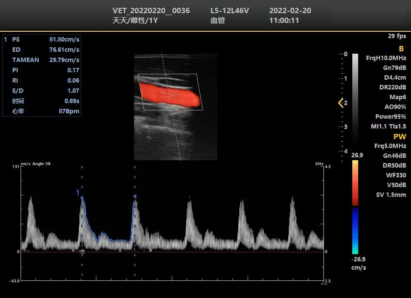 Portable Ultrasound