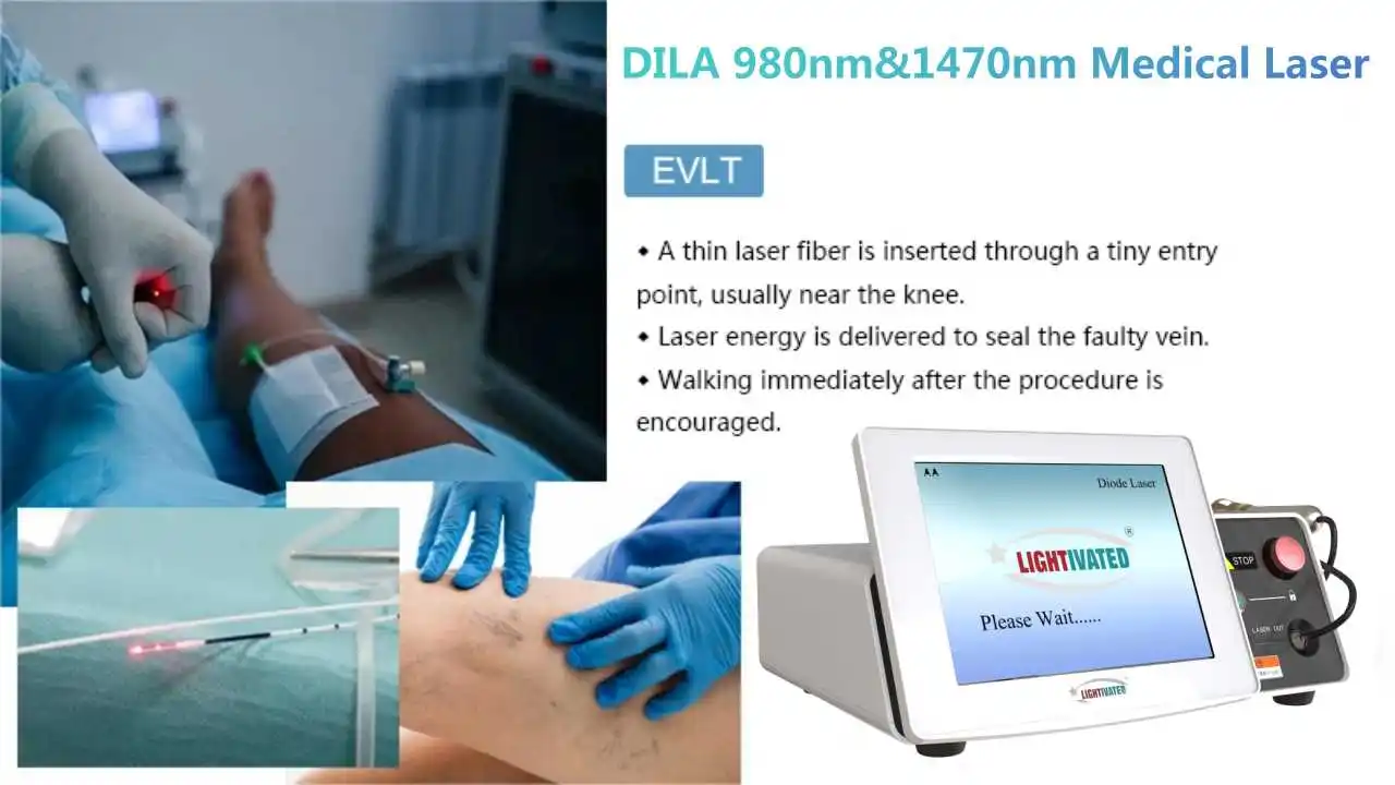 Ec Approved 980nm Endovenous Medical Laser 1470nm Varicose Veins ...