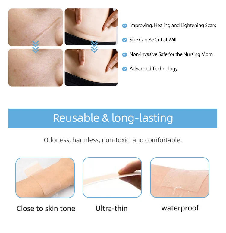 Soft Silicone Scar Sheets Effective Scar Strips Removal Treatment For C