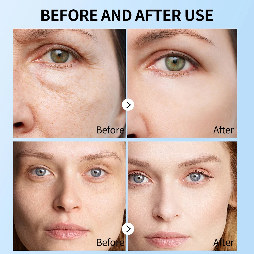 6 Types Capsule Face Mask Sheet Skin Care Hydrating Firming Anti Aging 25ml Pearl Collagen Caviar HA Snail MOOYAM Facial Mask