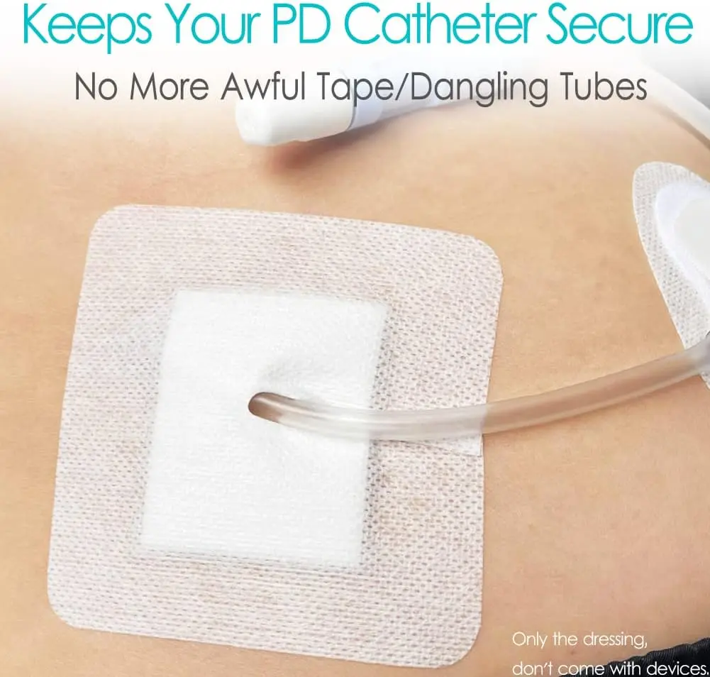 Catheter Fixation Dressing Peritoneal Dialysis Pd Catheter Bordered ...