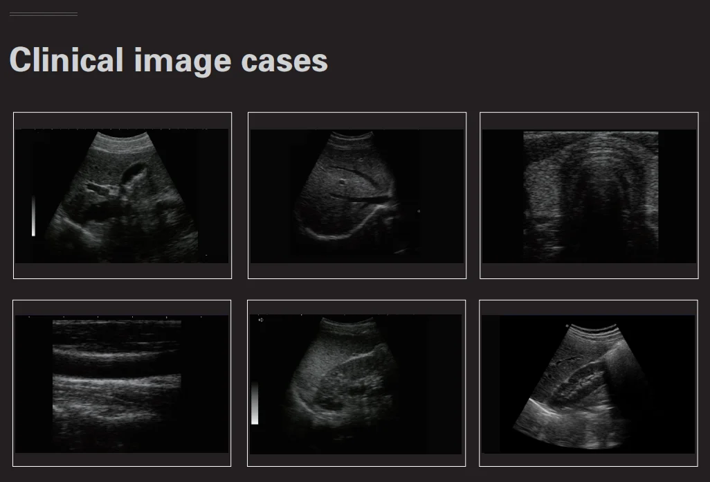 B/W Portable Ultrasound System Scanner YJ-U580