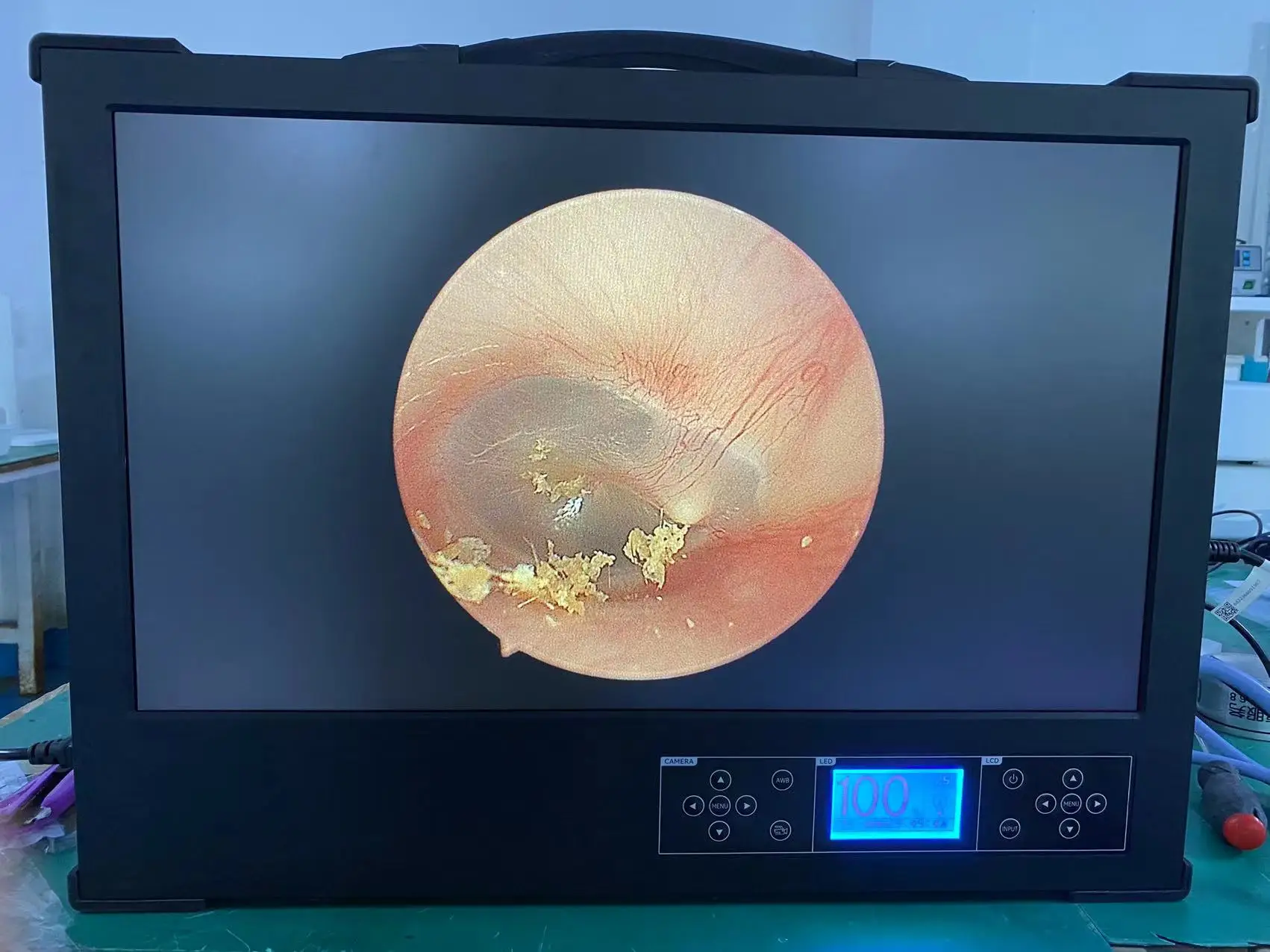 3 in 1 Integrated Endoscope Camera Used for Rigid Endoscopes